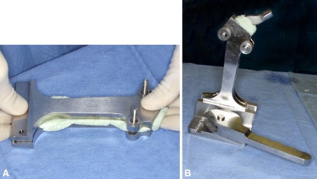 Fig. 1A–B