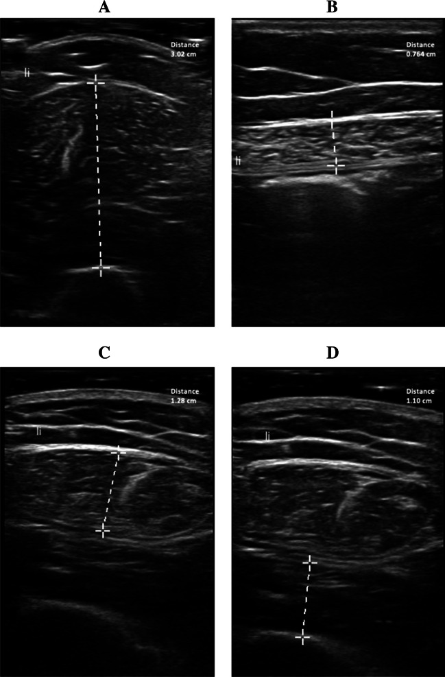 Fig. 1