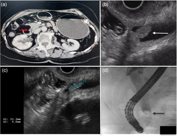 FIGURE 1