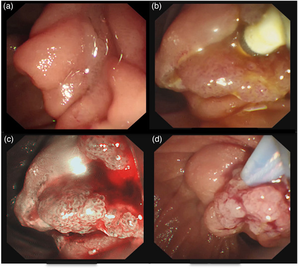 FIGURE 2