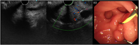 FIGURE 4