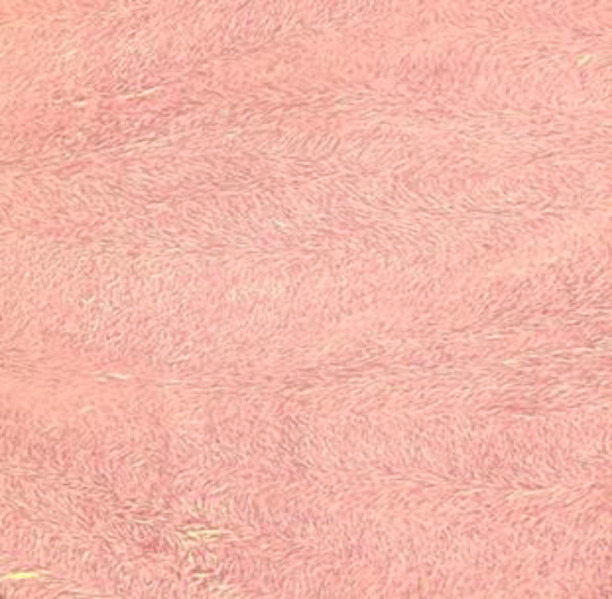 Fig 9