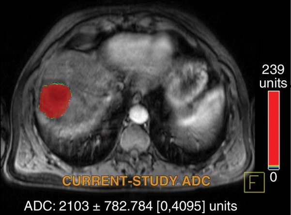 Figure 4d: