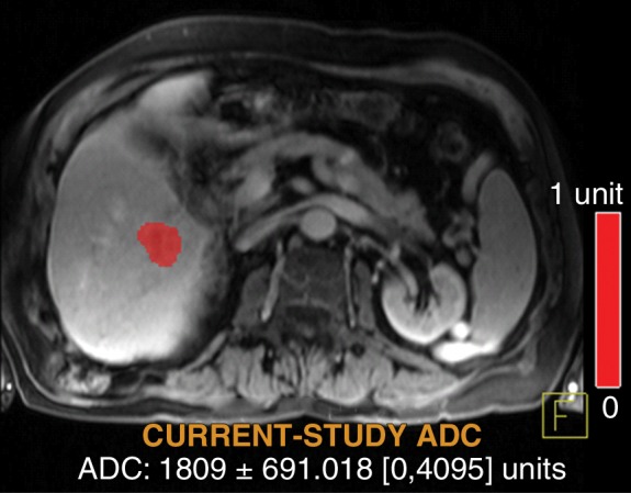 Figure 5d: