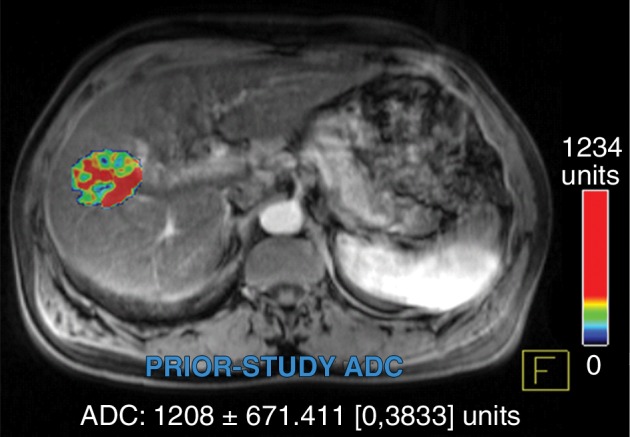 Figure 4a: