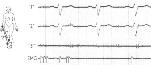 FIG 2