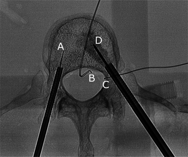 Fig. 1