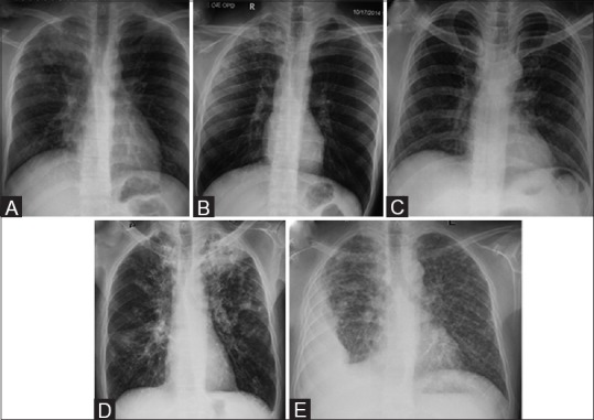 Figure 2 (A-E)