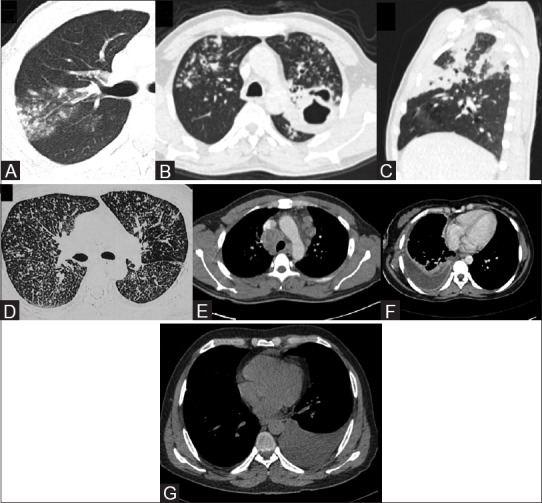 Figure 3 (A-G)