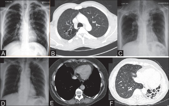 Figure 4(A-F)