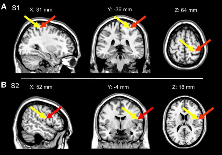 Fig. 2