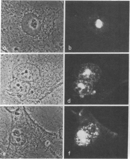 graphic file with name pnas00006-0331-a.jpg