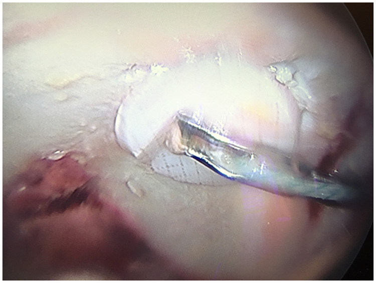 Fig. 10.