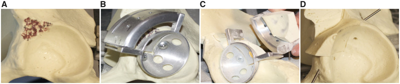 Fig. 11.