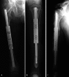 Fig. 1A–C