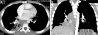 Fig. 13