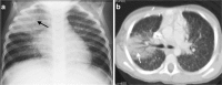 Fig. 11