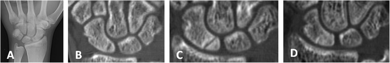 Fig. 6