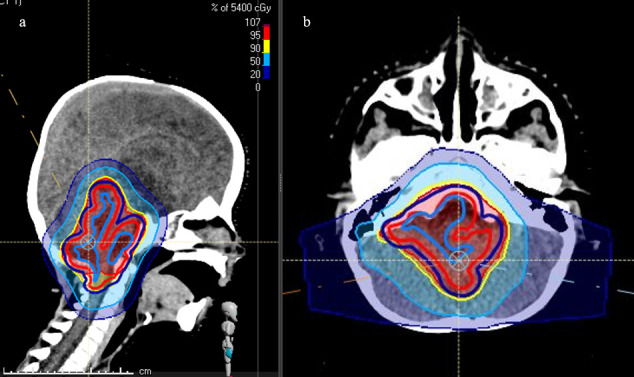 Figure 3. 