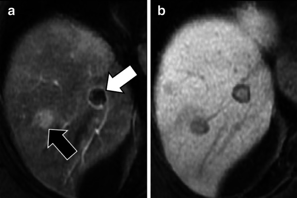 Fig. 10