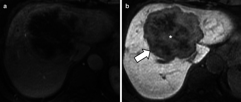 Fig. 11