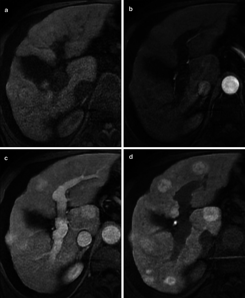 Fig. 16