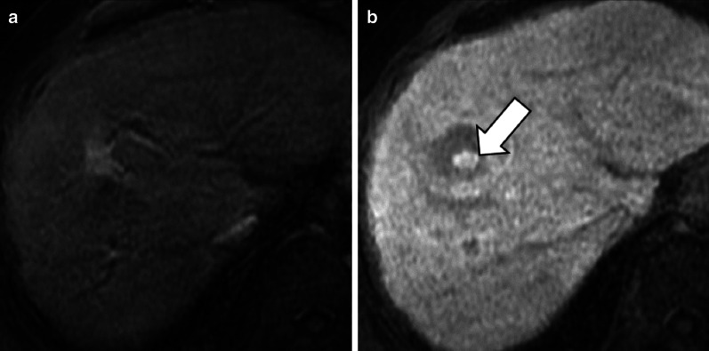 Fig. 13