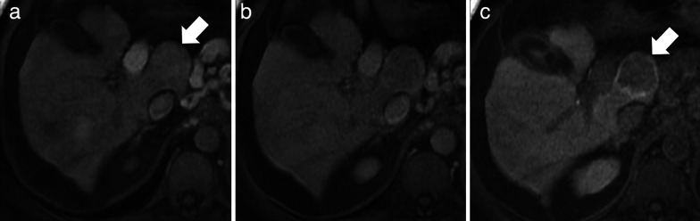 Fig. 14