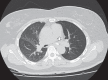 Figure 2)