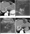 Fig. 11