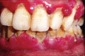 Figure 2a