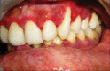 Figure 6b