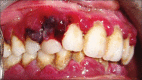 Figure 2c