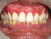 Figure 6a