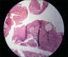 Figure 4b