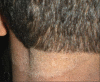 Figure 1b