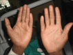 Figure 1d