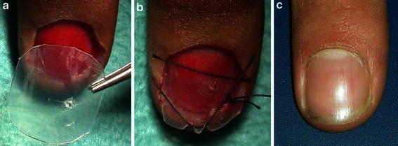 Fig. 2