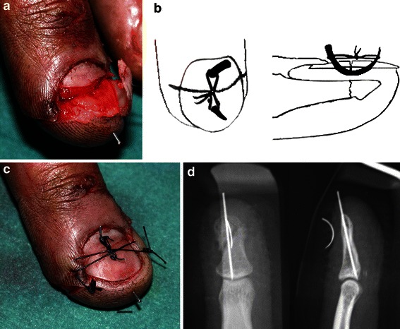 Fig. 3