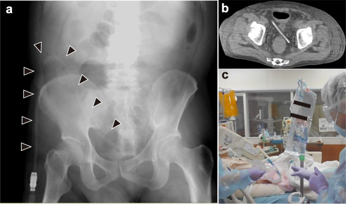 Fig. 1