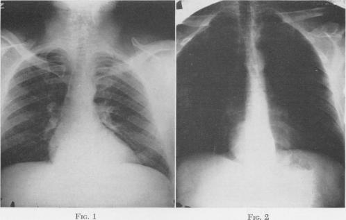 Fig. 1, Fig. 2