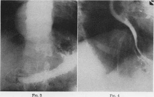 Fig. 3, Fig. 4