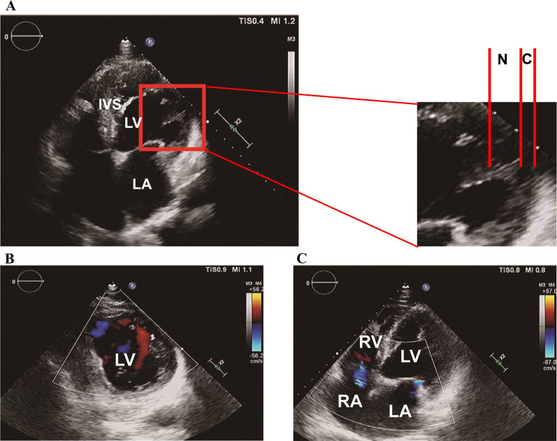 Fig. 3