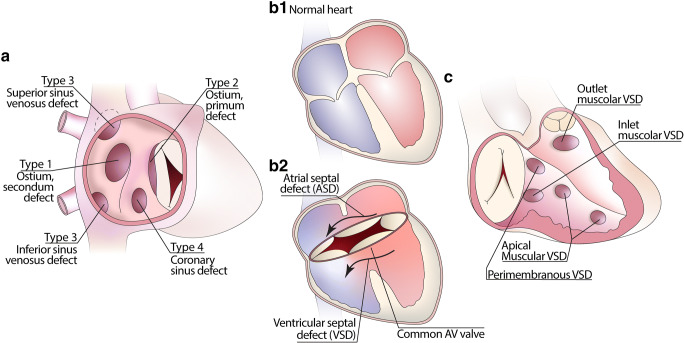 Fig. 1