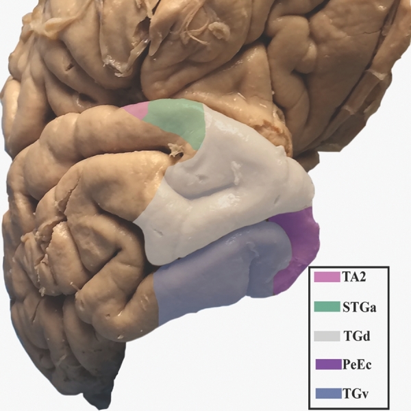 FIGURE 29.