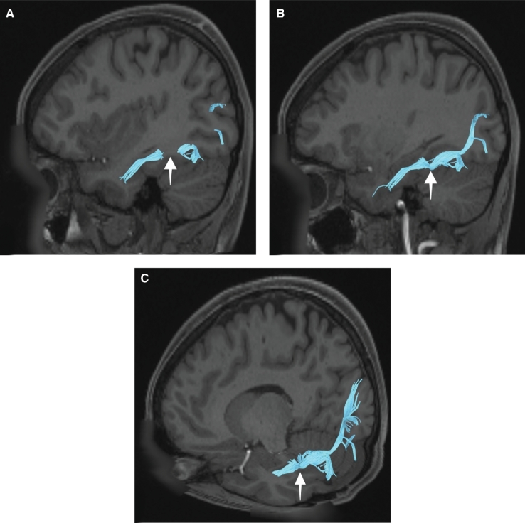 FIGURE 46.