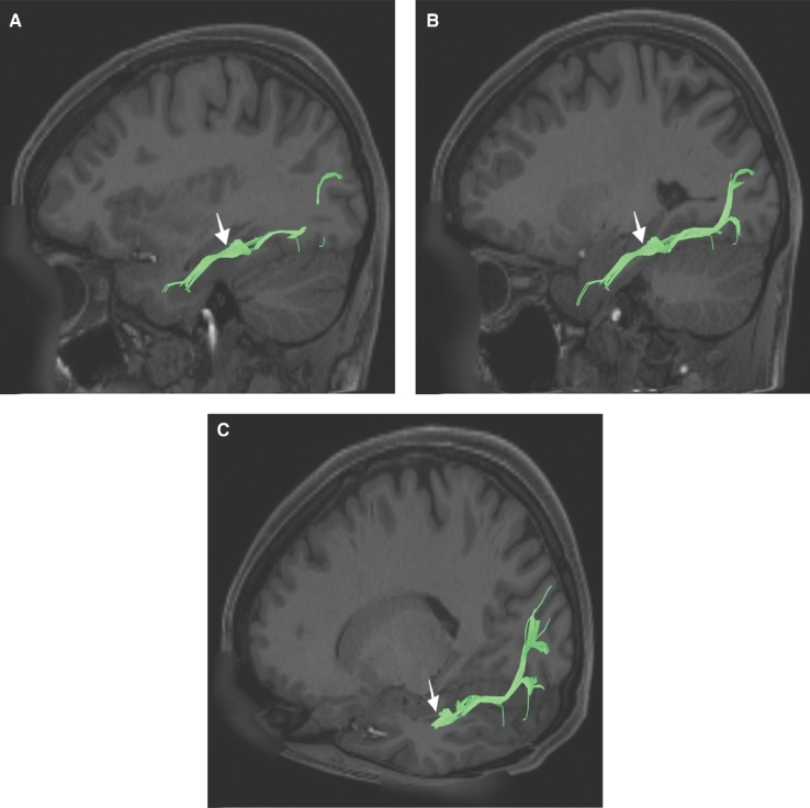 FIGURE 44.