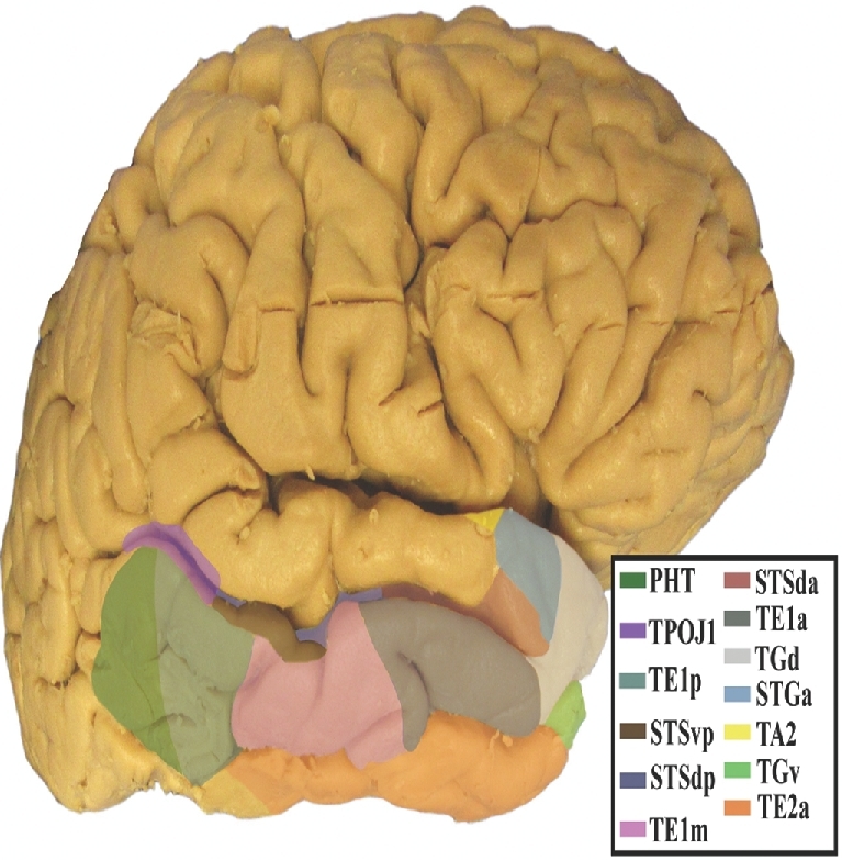 FIGURE 11.