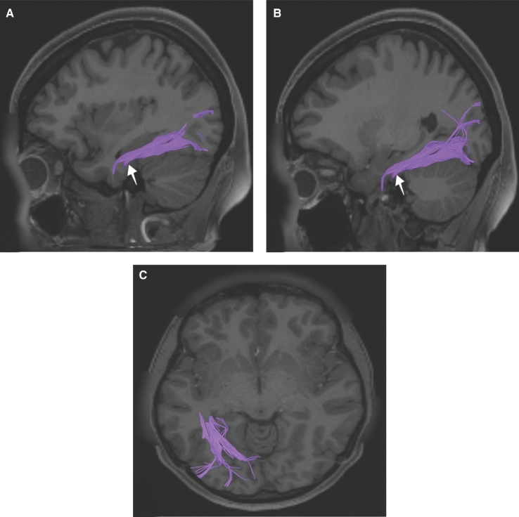 FIGURE 42.