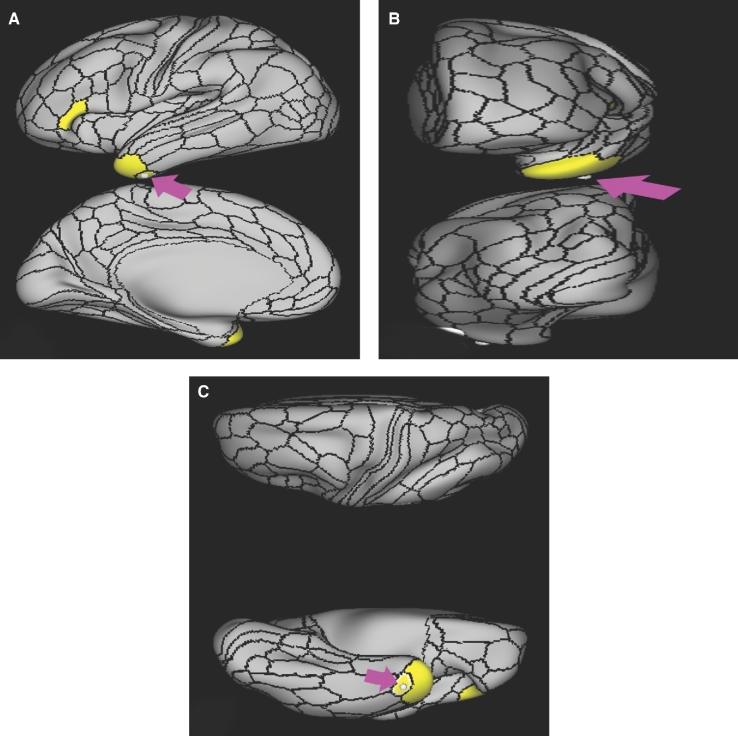 FIGURE 33.